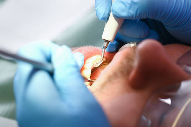 Best Emergency Dental Care for Trauma or Injury in Combes, TX