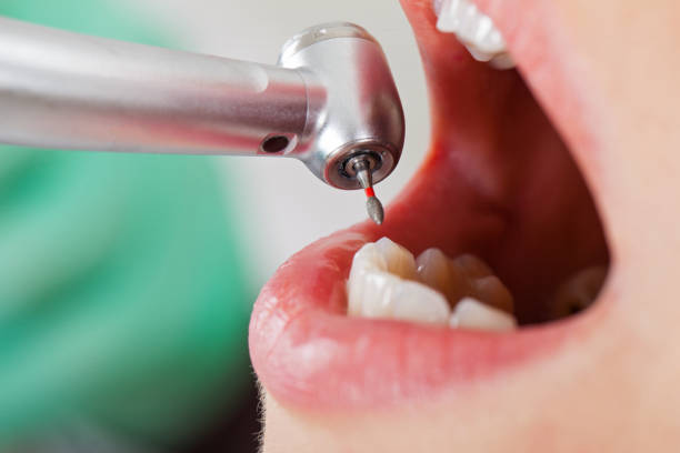 Best Pediatric Emergency Dentist in Combes, TX
